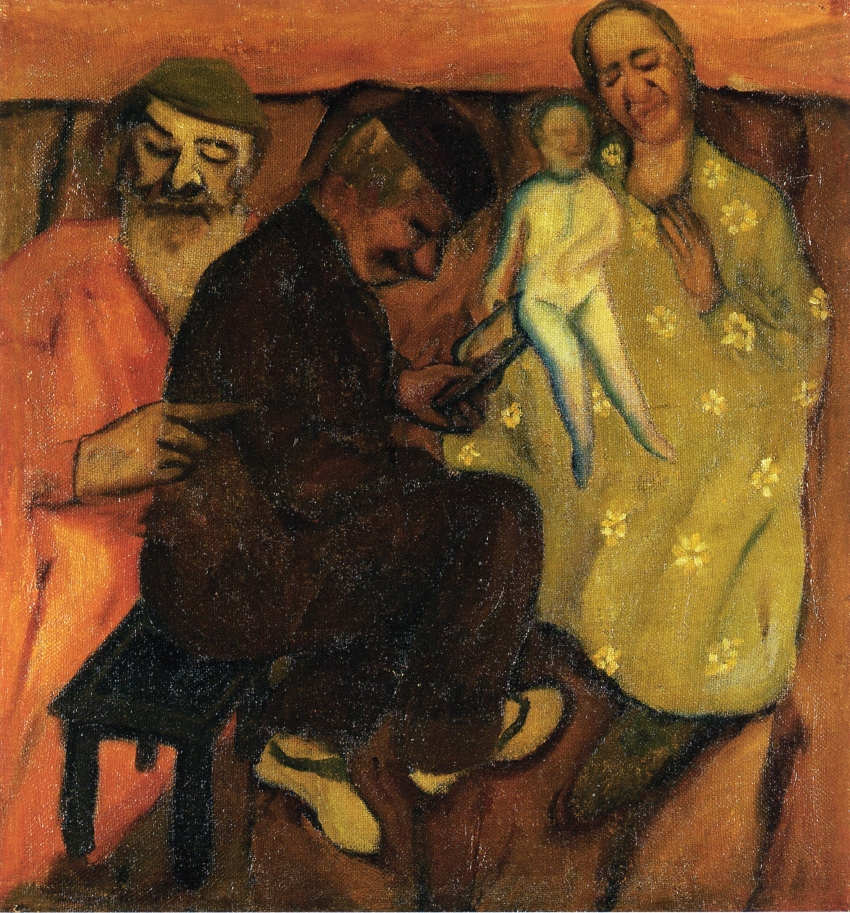 Circumcision (1909).